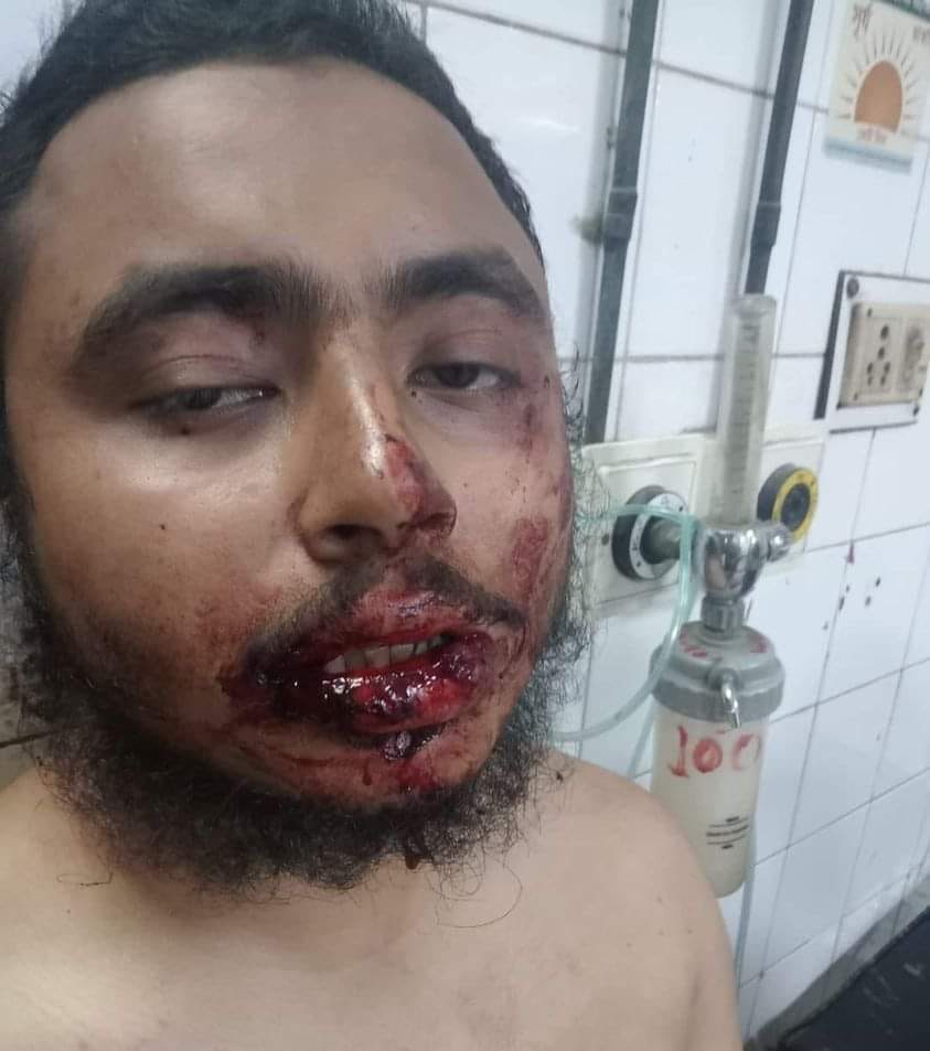 ঢাবিতে রমজানের আলোচনা সভা ও ইফতার মাহফিলে ছাত্রলীগের হামলা, আহত ৭