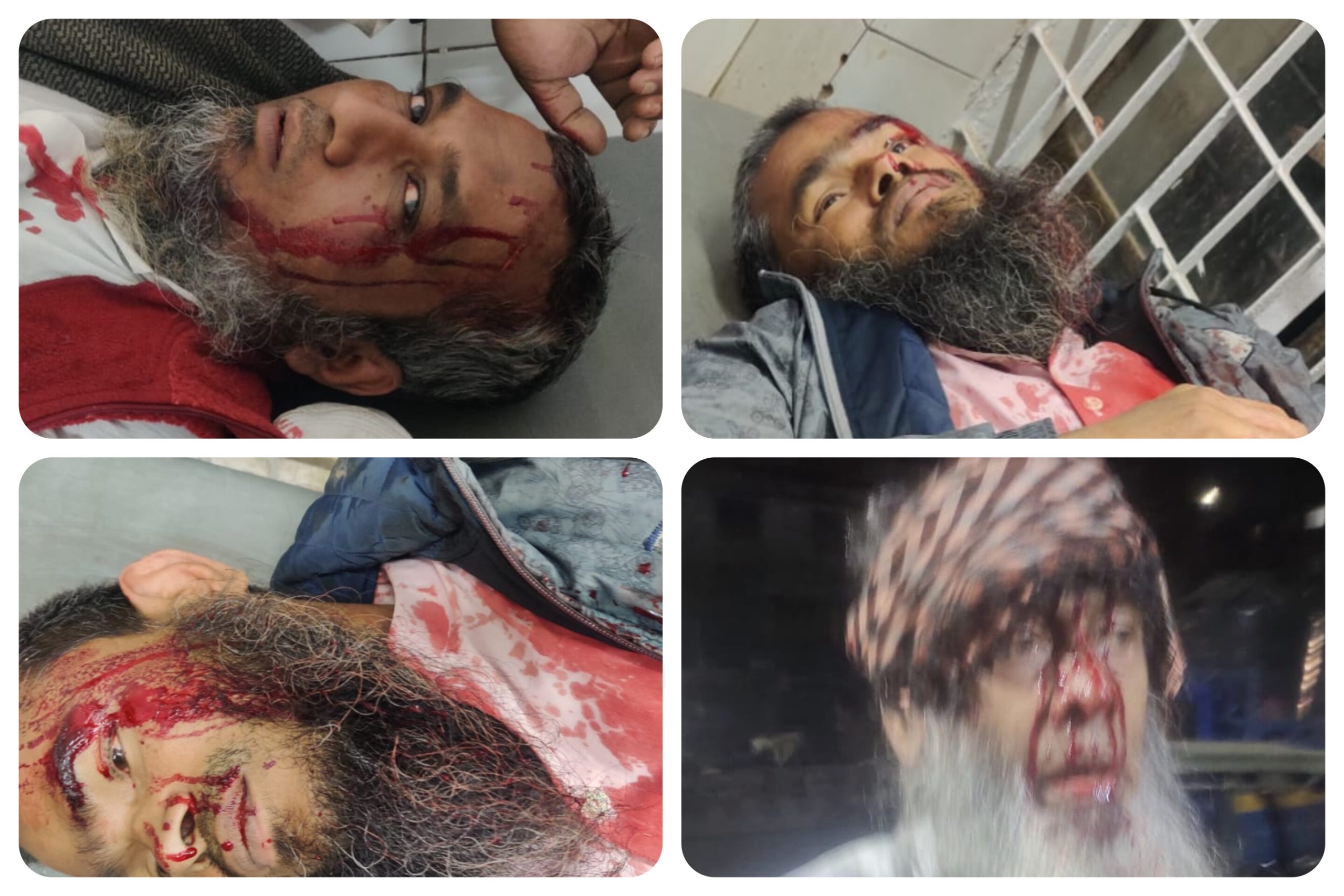 গাজীপুরে টঙ্গীর ইজতেমা মাঠের দখল নিয়ে মাওলানা জুবায়ের ও মাওলানা সাদ কান্ধলভীর অনুসারীদের মধ্যে সংঘর্ষের ঘটনা ঘটেছে। এতে দুজনের মৃত্যু হয়েছে বলে পুলিশ আজ বুধবার জানিয়েছে।