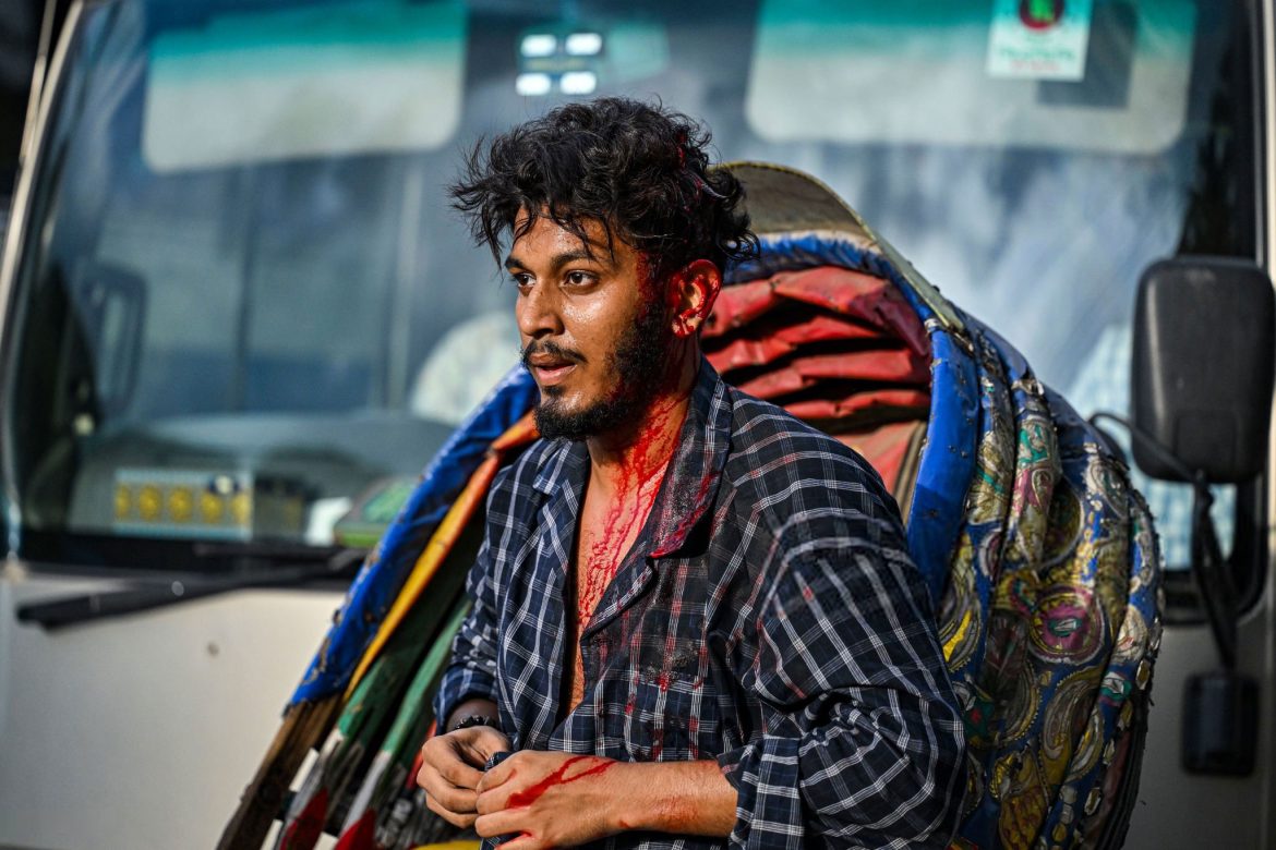 ছাত্রলীগের নির্যাতনের শিকার এক বৈষম্যবিরোধী ছাত্র। ২০২৪ সালের ১৫ জুলাই ঢাবি ক্যাম্পাস থেকে তোলা ছবি।