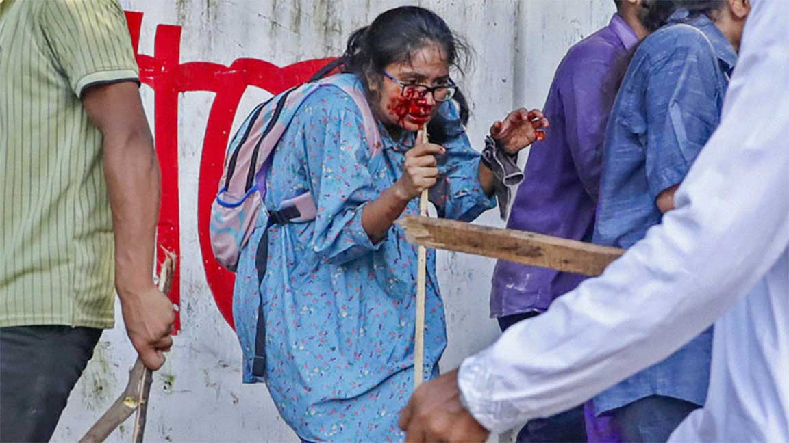 জুলাইয়ে আহত সানজিদা আহমেদ তন্বি। ফাইল ফটো